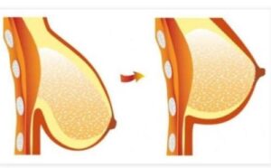 Dr. JIM Breast Enlargement Cream - Image 3
